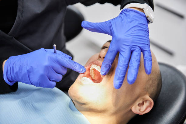 Best Emergency Dental Care for Broken or Chipped Teeth in Wilmington, OH